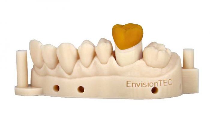 casting dental crown insert 3d printed new zealand
